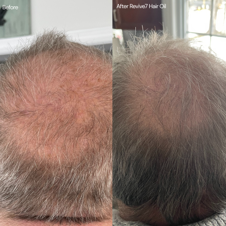 Revive7 Hair Oil