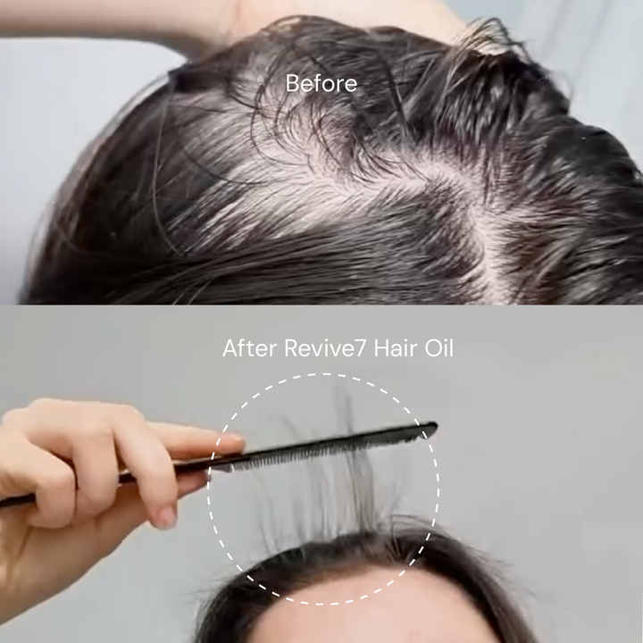 Revive7 Hair Oil