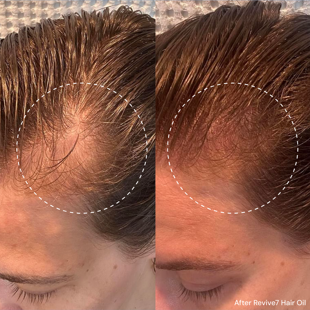 Revive7 Hair Oil