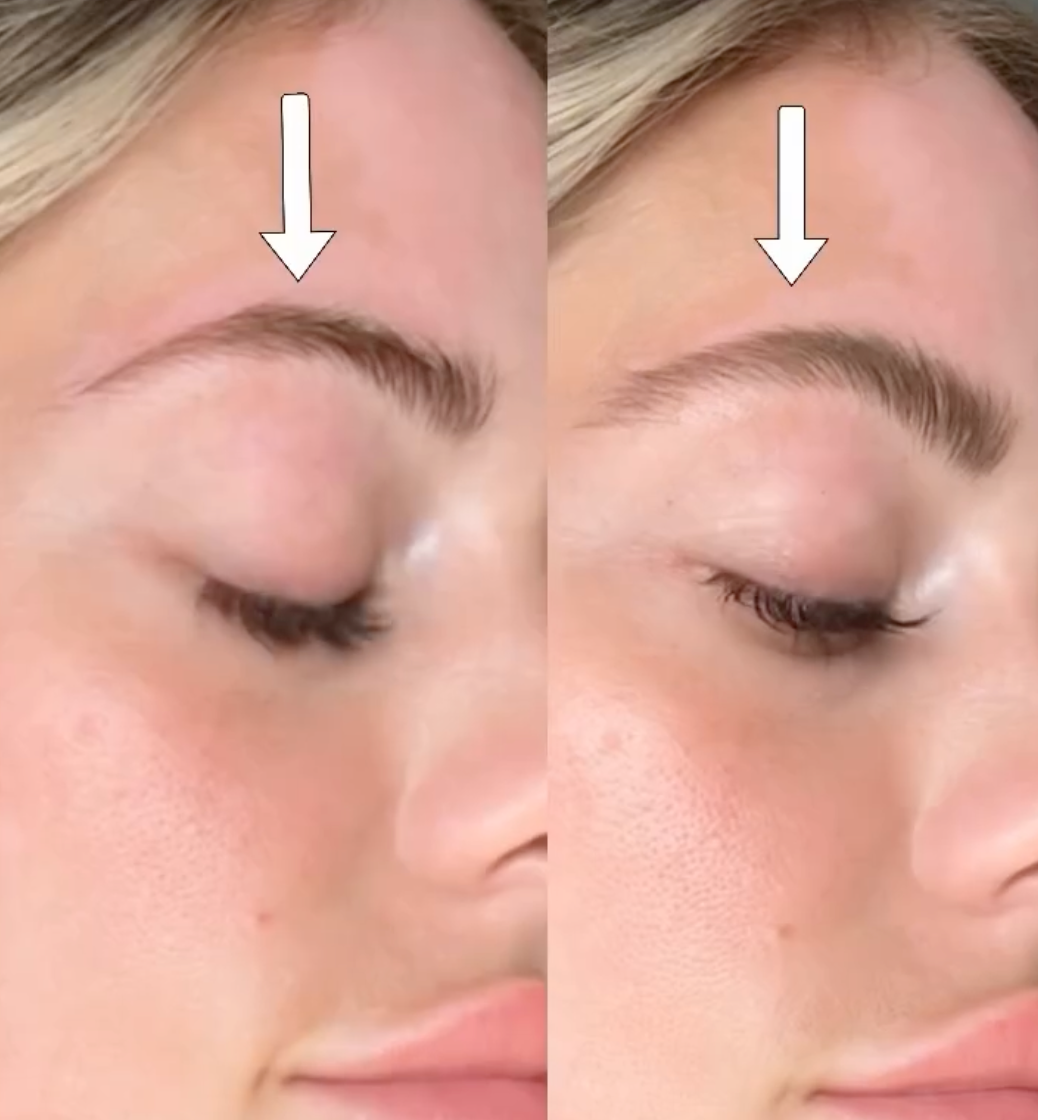 Revive7 Brow Boost Kit